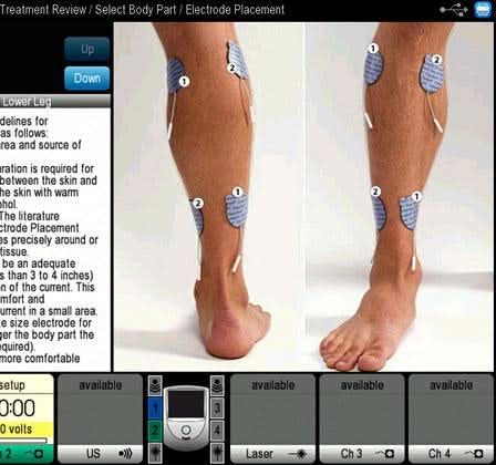 Chattanooga Intelect NEO Stim Module CH. 1&2 + EMG - Image 4