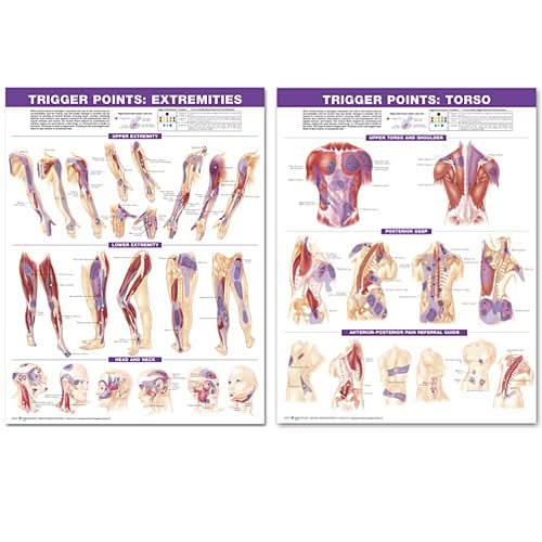 Trigger Point Chart Set: Torso and Extremities